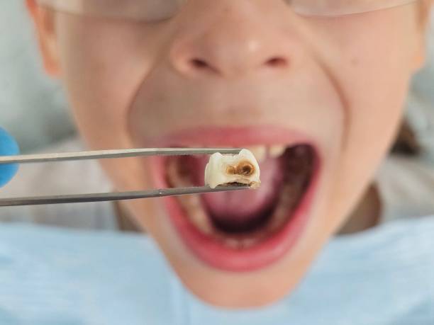 Best Emergency Broken Tooth Repair in Haddon Heights, NJ